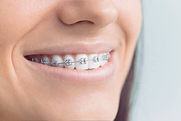 Best Teeth Whitening  in Gardere, LA